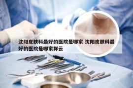 沈阳皮肤科最好的医院是哪家 沈阳皮肤科最好的医院是哪家祥云
