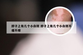 脖子上有几个小白斑 脖子上有几个小白斑不痛不痒