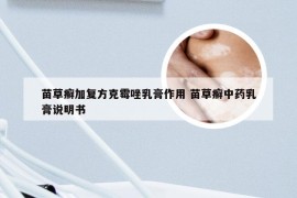 苗草癣加复方克霉唑乳膏作用 苗草癣中药乳膏说明书