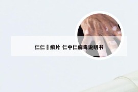 仁仁栢癣片 仁中仁癣毒说明书