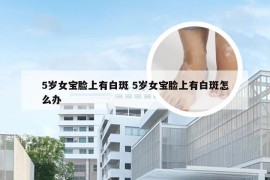 5岁女宝脸上有白斑 5岁女宝脸上有白斑怎么办