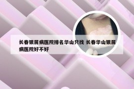 长春银屑病医院排名华山只找 长春华山银屑病医院好不好