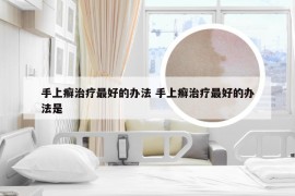 手上癣治疗最好的办法 手上癣治疗最好的办法是