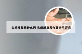头癣反复用什么药 头癣反复发作真治不好吗