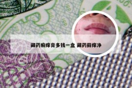 藏药癣痒膏多钱一盒 藏药藓痒净