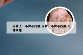 皮肤上一小片小疙瘩 皮肤一小片小疙瘩,不疼不痒