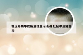 社区开展牛皮癣清理整治活动 社区牛皮鲜整治