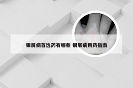 银屑病首选药有哪些 银屑病用药指南