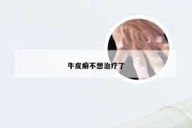 牛皮癣不想治疗了