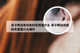 鼻子两边有白色的东西是什么 鼻子两边白色的东西是什么图片