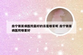 南宁银屑病医院最好的该是哪家呢 南宁银屑病医院哪里好