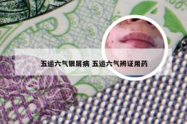 五运六气银屑病 五运六气辨证用药