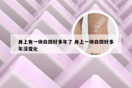 身上有一块白斑好多年了 身上一块白斑好多年没变化