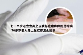 七十二岁老太太身上皮肤起疙瘩痒痒的是啥病 70多岁老人身上起红疹怎么回事