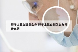 脖子上起白斑怎么办 脖子上起白斑怎么办用什么药