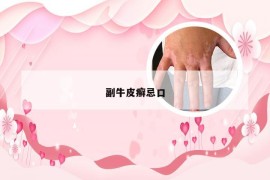 副牛皮癣忌口
