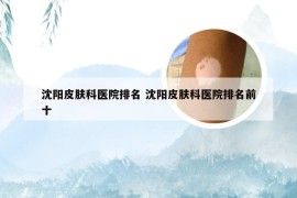 沈阳皮肤科医院排名 沈阳皮肤科医院排名前十