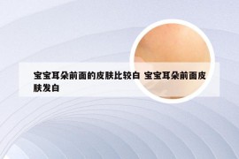 宝宝耳朵前面的皮肤比较白 宝宝耳朵前面皮肤发白