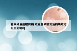 薏米红豆副银屑病 红豆薏米银耳汤的功效可以天天喝吗