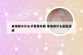 身体缺少什么才容易长癣 身体缺什么能起皮疹