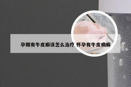 孕期有牛皮癣该怎么治疗 怀孕有牛皮病癣