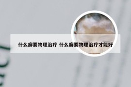 什么癣要物理治疗 什么癣要物理治疗才能好