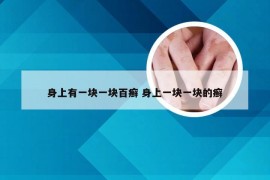 身上有一块一块百癣 身上一块一块的癣