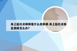 身上起红点痒痒是什么皮肤病 身上起红点而且很痒怎么办?