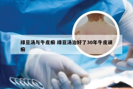 绿豆汤与牛皮癣 绿豆汤治好了30年牛皮顽癣