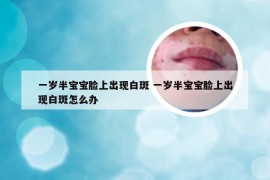 一岁半宝宝脸上出现白斑 一岁半宝宝脸上出现白斑怎么办