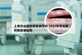 上海华山医院银屑病专科 2021年华山医院银屑病贴吧
