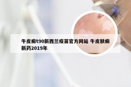 牛皮癣t90新西兰疫苗官方网站 牛皮肤癣新药2019年