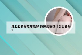 身上起的癣吃啥能好 身体长癣吃什么比较好?