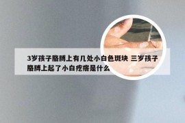 3岁孩子胳膊上有几处小白色斑块 三岁孩子胳膊上起了小白疙瘩是什么