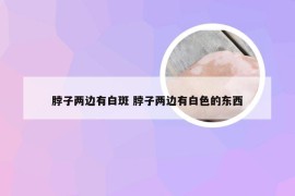 脖子两边有白斑 脖子两边有白色的东西