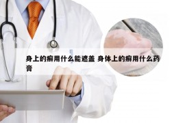 身上的癣用什么能遮盖 身体上的癣用什么药膏