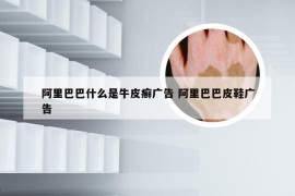 阿里巴巴什么是牛皮癣广告 阿里巴巴皮鞋广告