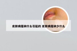 皮肤病是缺什么引起的 皮肤病是缺少什么