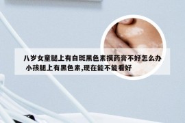八岁女童腿上有白斑黑色素摸药膏不好怎么办 小孩腿上有黑色素,现在能不能看好