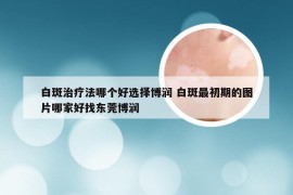 白斑治疗法哪个好选择博润 白斑最初期的图片哪家好找东莞博润