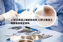 13岁小男孩上嘴唇有白斑 13岁小男孩上嘴唇有白斑正常吗