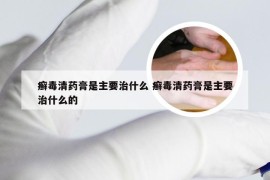 癣毒清药膏是主要治什么 癣毒清药膏是主要治什么的