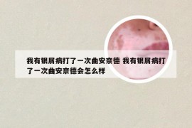 我有银屑病打了一次曲安奈德 我有银屑病打了一次曲安奈德会怎么样