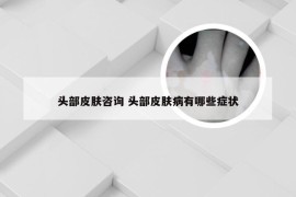 头部皮肤咨询 头部皮肤病有哪些症状