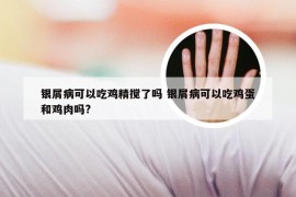 银屑病可以吃鸡精搅了吗 银屑病可以吃鸡蛋和鸡肉吗?