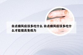 白点癫风应该多吃什么 白点癫风应该多吃什么才能提高免疫力