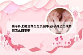 孩子身上出现白斑怎么回事 孩子身上出现白斑怎么回事啊