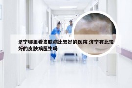 济宁哪里看皮肤病比较好的医院 济宁有比较好的皮肤病医生吗