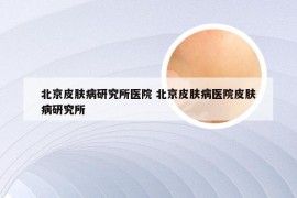 北京皮肤病研究所医院 北京皮肤病医院皮肤病研究所