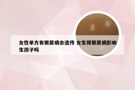女性单方有银屑病会遗传 女生得银屑病影响生孩子吗